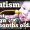 AUTISM: First Sign at 6 months old