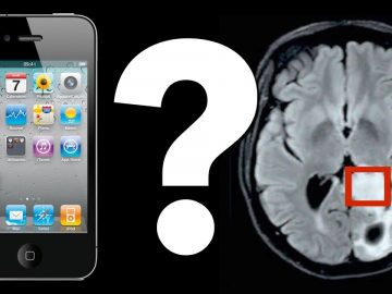 Do Cell Phones Cause Brain Tumors?