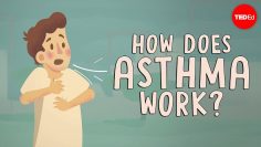 How does asthma work? – 克里斯托弗·E. 嘎