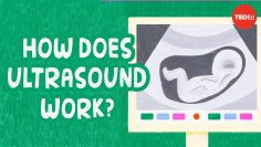 How to see with sound – Jacques S. Abramowicz