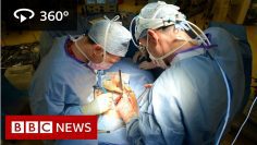 In 360: Oesophageal cancer operation filmed – BBC News