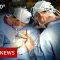 In 360: Oesophageal cancer operation filmed – BBC News