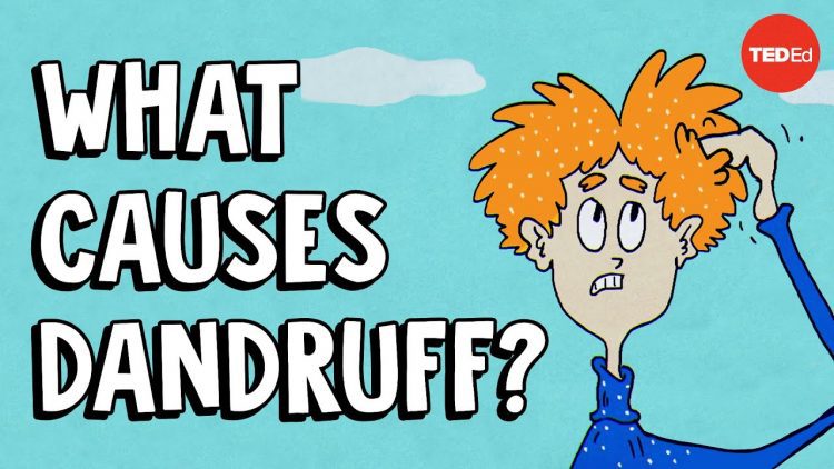 What causes dandruff, and how do you get rid of it? – Thomas L. Dawson