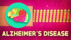 What is Alzheimers disease? – Ivan Seah Yu Jun