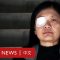 香港示威：右眼失明的印尼女記者控訴「警暴」－ BBC News 中文