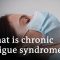 The mysterious disease that affects millions of people worldwide | DW Documentary